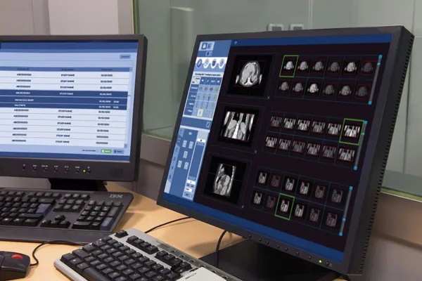 Monitor professionale con immagini diagnostiche visualizzate nei piani anatomici coronale, sagittale e frontale, insieme ai controlli dell'interfaccia software. Elena Lazzara realizza un sistema visivo che rende più chiara la navigazione tra le acquisizioni mediche e la ricostruzione tridimensionale delle immagini.